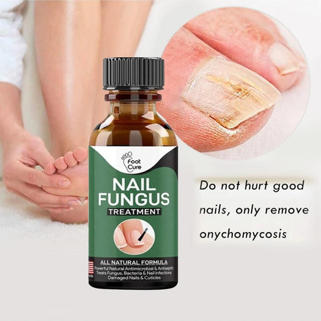 Nail Fungal Repair Serum | Nail Fungus Removal Gel
